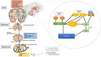 Cognition and Pain: A Review